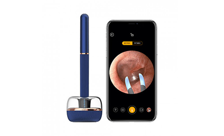 Bebird Note3 wireless visual ear wax removal Experience Summary