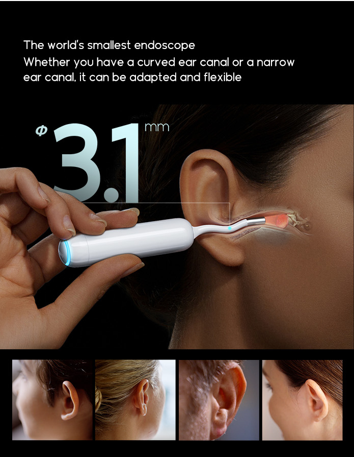 Bebird Home30S:  The Smartest Visual Ear Care Kit for family